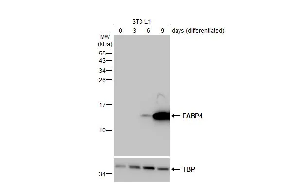 Various whole cell extracts (30 μg) were separated by 15% SDS-PAGE, and the membrane was blotted with FABP4 antibody [HL1521] (GTX636995) diluted at 1:5000. The HRP-conjugated anti-rabbit IgG antibody (GTX213110-01) was used to detect the primary antibody.