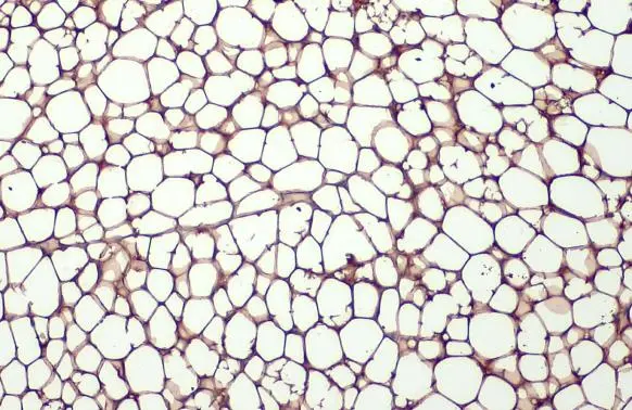 FABP4 antibody [HL1521] detects FABP4 protein at cytoplasm by immunohistochemical analysis. Sample: Paraffin-embedded mouse white adipocyte. FABP4 stained by FABP4 antibody [HL1521] (GTX636995) diluted at 1:100. Antigen Retrieval: Citrate buffer, pH 6.0, 15 min