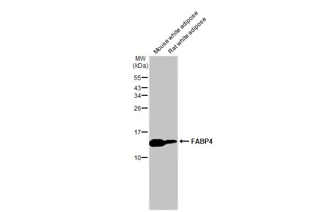 Various tissue extracts (50 μg) were separated by 15% SDS-PAGE, and the membrane was blotted with FABP4 antibody [HL1521] (GTX636995) diluted at 1:5000. The HRP-conjugated anti-rabbit IgG antibody (GTX213110-01) was used to detect the primary antibody.