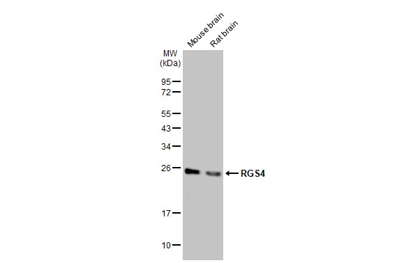 Various tissue extracts (50 μg) were separated by 12% SDS-PAGE, and the membrane was blotted with RGS4 antibody [HL1522] (GTX636996) diluted at 1:1000. The HRP-conjugated anti-rabbit IgG antibody (GTX213110-01) was used to detect the primary antibody, and the signal was developed with Trident ECL plus-Enhanced.
