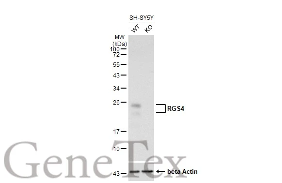Unboiled wild-type (WT) and RGS4 knockout (KO) SH-SY5Y cell extracts (15 μg) were separated by 12% SDS-PAGE, and the membrane was blotted with RGS4 antibody [HL1522] (GTX636996) diluted at 1:1000. The HRP-conjugated anti-rabbit IgG antibody (GTX213110-01) was used to detect the primary antibody.