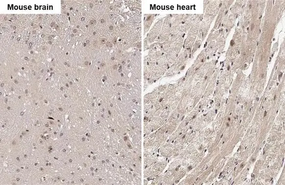 RGS4 antibody [HL1522] detects RGS4 protein by immunohistochemical analysis. Sample: Paraffin-embedded mouse tissues. RGS4 stained by RGS4 antibody [HL1522] (GTX636996) diluted at 1:100. Antigen Retrieval: Citrate buffer, pH 6.0, 15 min