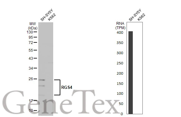 Various whole cell extracts (30 μg) were separated by 12% SDS-PAGE, and the membrane was blotted with RGS4 antibody [HL1522] (GTX636996) diluted at 1:200. The HRP-conjugated anti-rabbit IgG antibody (GTX213110-01) was used to detect the primary antibody. Corresponding RNA expression data for the same cell lines are based on Human Protein Atlas program.