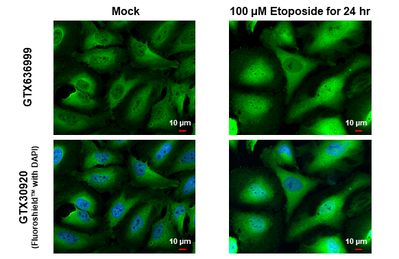 DNA polymerase beta antibody [HL1525] detects DNA polymerase beta protein at cytoplasm and nucleus by immunofluorescent analysis. Sample: Mock and treated HeLa cells were fixed in 4% paraformaldehyde at RT for 15 min. Green: DNA polymerase beta stained by DNA polymerase beta antibody [HL1525] (GTX636999) diluted at 1:500. Red: alpha Tubulin, a cytoskeleton marker, stained by alpha Tubulin antibody [GT114] (GTX628802) diluted at 1:1000. Blue: Fluoroshield with DAPI (GTX30920).