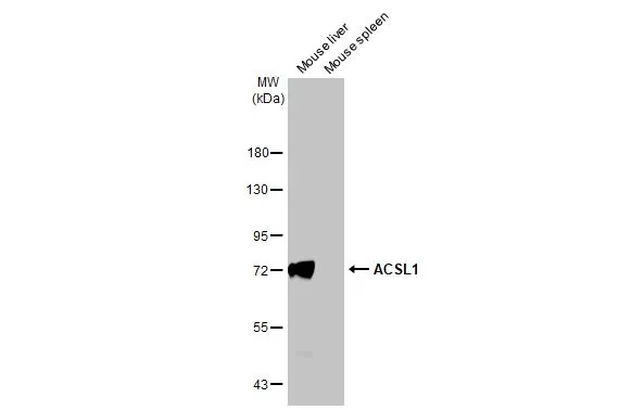Various tissue extracts (50 μg) were separated by 7.5% SDS-PAGE, and the membrane was blotted with ACSL1 antibody [HL1530] (GTX637003) diluted at 1:20000. The HRP-conjugated anti-rabbit IgG antibody (GTX213110-01) was used to detect the primary antibody.