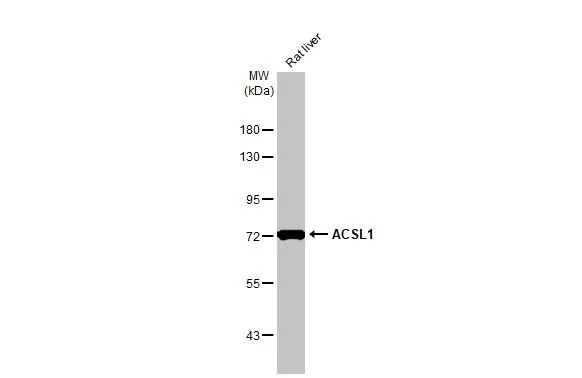 Rat tissue extract (50 μg) was separated by 7.5% SDS-PAGE, and the membrane was blotted with ACSL1 antibody [HL1530] (GTX637003) diluted at 1:20000. The HRP-conjugated anti-rabbit IgG antibody (GTX213110-01) was used to detect the primary antibody.
