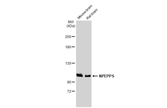 Various tissue extracts (50 μg) were separated by 5% SDS-PAGE, and the membrane was blotted with NPEPPS antibody [HL1531] (GTX637005) diluted at 1:3000. The HRP-conjugated anti-rabbit IgG antibody (GTX213110-01) was used to detect the primary antibody.