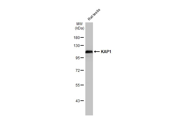 Rat tissue extract (50 μg) was separated by 7.5% SDS-PAGE, and the membrane was blotted with KAP1 antibody [HL1539] (GTX637013) diluted at 1:5000. The HRP-conjugated anti-rabbit IgG antibody (GTX213110-01) was used to detect the primary antibody.