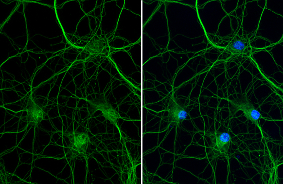 VRL1 antibody [HL1543] detects VRL1 protein at fiber by immunofluorescent analysis. Sample: DIV9 rat E18 primary hippocampal neuron cells were fixed in 4% paraformaldehyde at RT for 15 min. Green: VRL1 stained by VRL1 antibody [HL1543] (GTX637018) diluted at 1:250. Blue: Fluoroshield with DAPI (GTX30920).