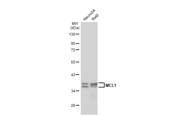 Various whole cell extracts (30 μg) were separated by 10% SDS-PAGE, and the membrane was blotted with MCL1 antibody [HL1544] (GTX637019) diluted at 1:1000. The HRP-conjugated anti-rabbit IgG antibody (GTX213110-01) was used to detect the primary antibody.