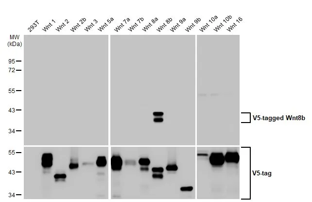 Non-transfected (–) and transfected (+) 293T whole cell extracts (30 μg) were separated by 10% SDS-PAGE, and the membrane was blotted with Wnt8b antibody [HL1549] (GTX637024) diluted at 1:5000. The HRP-conjugated anti-rabbit IgG antibody (GTX213110-01) was used to detect the primary antibody.