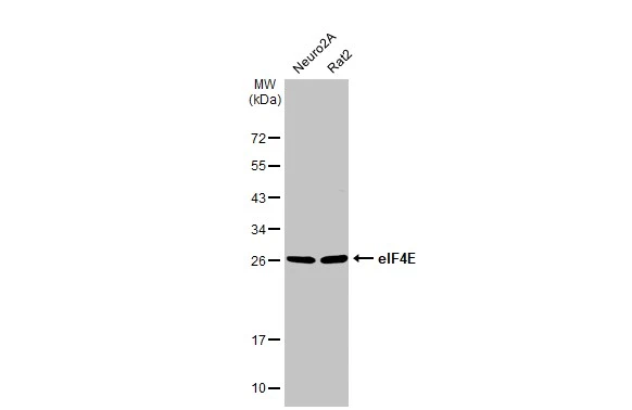 Various whole cell extracts (30 μg) were separated by 12% SDS-PAGE, and the membrane was blotted with eIF4E antibody [HL1553] (GTX637028) diluted at 1:1000. The HRP-conjugated anti-rabbit IgG antibody (GTX213110-01) was used to detect the primary antibody.