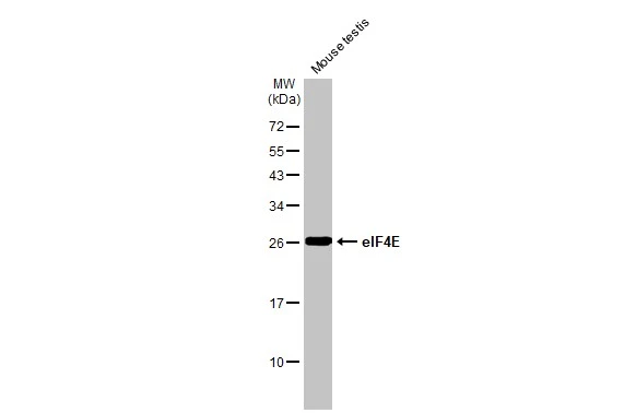Mouse tissue extract (50 μg) was separated by 12% SDS-PAGE, and the membrane was blotted with eIF4E antibody [HL1553] (GTX637028) diluted at 1:1000. The HRP-conjugated anti-rabbit IgG antibody (GTX213110-01) was used to detect the primary antibody.