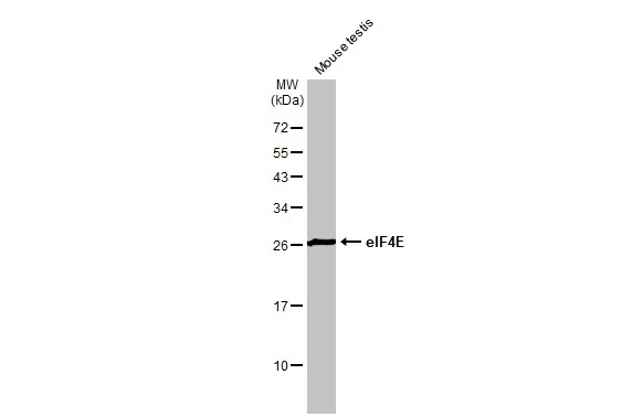 Mouse tissue extract (50 μg) was separated by 12% SDS-PAGE, and the membrane was blotted with eIF4E antibody [HL1554] (GTX637029) diluted at 1:1000. The HRP-conjugated anti-rabbit IgG antibody (GTX213110-01) was used to detect the primary antibody.