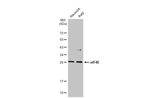 Various whole cell extracts (30 μg) were separated by 12% SDS-PAGE, and the membrane was blotted with eIF4E antibody [HL1554] (GTX637029) diluted at 1:1000. The HRP-conjugated anti-rabbit IgG antibody (GTX213110-01) was used to detect the primary antibody.