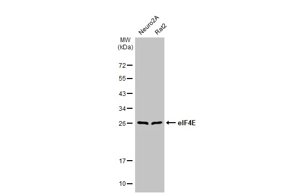 Various whole cell extracts (30 μg) were separated by 12% SDS-PAGE, and the membrane was blotted with eIF4E antibody [HL1555] (GTX637030) diluted at 1:1000. The HRP-conjugated anti-rabbit IgG antibody (GTX213110-01) was used to detect the primary antibody.
