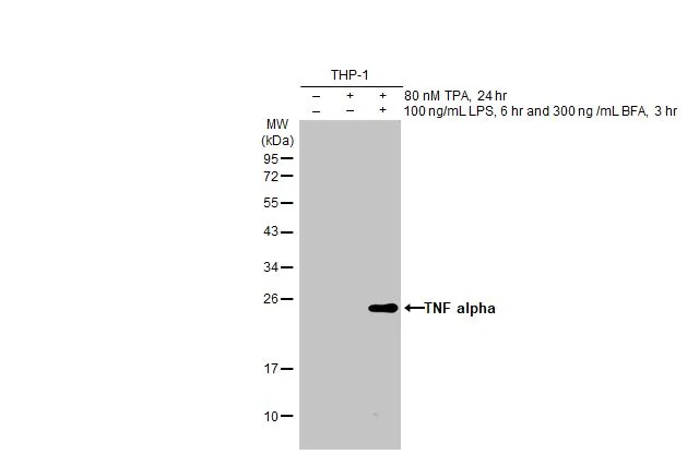 Untreated (–) and treated (+) THP-1 whole cell extracts (30 μg) were separated by 12% SDS-PAGE, and the membrane was blotted with TNF alpha antibody [HL1579] (GTX637058) diluted at 1:1000. The HRP-conjugated anti-rabbit IgG antibody (GTX213110-01) was used to detect the primary antibody.