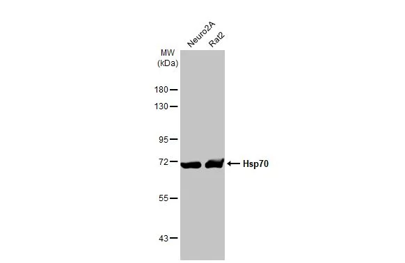 Various whole cell extracts (30 μg) were separated by 7.5% SDS-PAGE, and the membrane was blotted with Hsp70 antibody [HL1580] (GTX637059) diluted at 1:5000. The HRP-conjugated anti-rabbit IgG antibody (GTX213110-01) was used to detect the primary antibody.