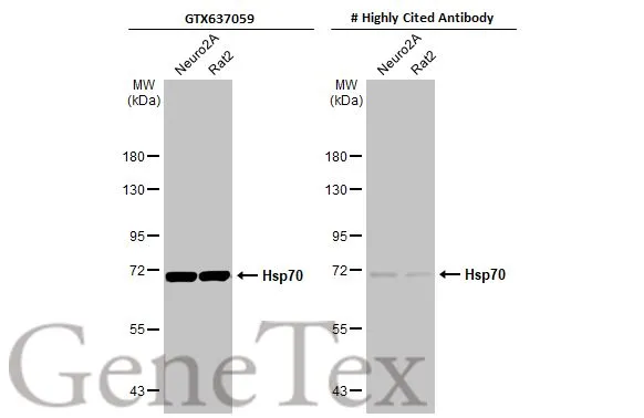 Various whole cell extracts (30 μg) were separated by 7.5% SDS-PAGE, and the membranes were blotted with Hsp70 antibody [HL1580] (GTX637059) diluted at 1:5000 and competitor's antibody (# Highly Cited Antibody) diluted at 1:5000. The HRP-conjugated anti-rabbit IgG antibody (GTX213110-01) was used to detect the primary antibody. *The competitor is not affiliated with GeneTex and does not endorse this product.