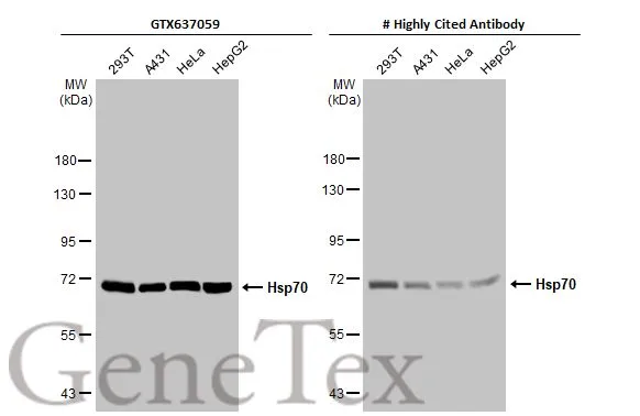 Various whole cell extracts (30 μg) were separated by 7.5% SDS-PAGE, and the membranes were blotted with Hsp70 antibody [HL1580] (GTX637059) diluted at 1:1000 and competitor's antibody (# Highly Cited Antibody) diluted at 1:1000. The HRP-conjugated anti-rabbit IgG antibody (GTX213110-01) was used to detect the primary antibody. *The competitor is not affiliated with GeneTex and does not endorse this product.