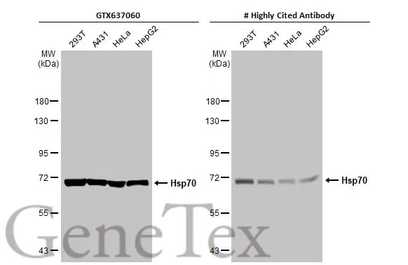 Various whole cell extracts (30 μg) were separated by 7.5% SDS-PAGE, and the membranes were blotted with Hsp70 antibody [HL1581] (GTX637060) diluted at 1:1000 and competitor's antibody (# Highly Cited Antibody) diluted at 1:1000. The HRP-conjugated anti-rabbit IgG antibody (GTX213110-01) was used to detect the primary antibody. *The competitor is not affiliated with GeneTex and does not endorse this product.