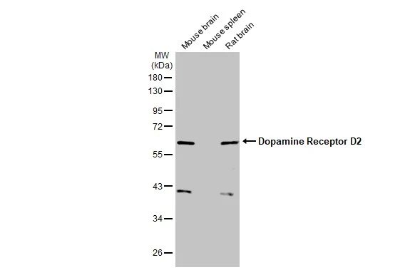Various tissue extracts (50 μg) were separated by 10% SDS-PAGE, and the membrane was blotted with Dopamine Receptor D2 antibody [HL1584] (GTX637063) diluted at 1:1000. The HRP-conjugated anti-rabbit IgG antibody (GTX213110-01) was used to detect the primary antibody.