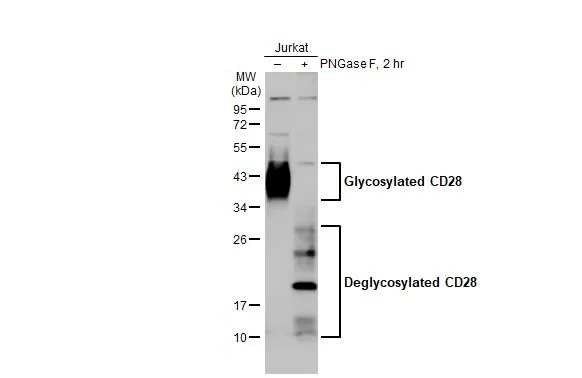 Untreated (–) and treated (+) Jurkat whole cell extracts (30 μg) were separated by 12% SDS-PAGE, and the membrane was blotted with CD28 antibody [HL1589] (GTX637068) diluted at 1:1000. The HRP-conjugated anti-rabbit IgG antibody (GTX213110-01) was used to detect the primary antibody.