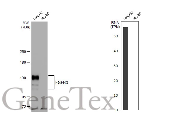 Various whole cell extracts (30 μg) were separated by 5% SDS-PAGE, and the membrane was blotted with FGFR3 antibody [HL1595] (GTX637074) diluted at 1:2000. The HRP-conjugated anti-rabbit IgG antibody (GTX213110-01) was used to detect the primary antibody.