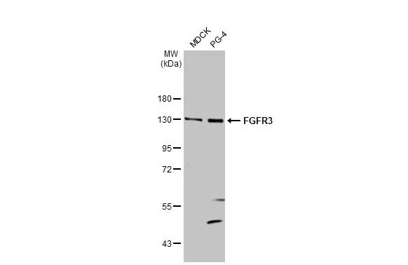 Various whole cell extracts (30 μg) were separated by 7.5% SDS-PAGE, and the membrane was blotted with FGFR3 antibody [HL1595] (GTX637074) diluted at 1:500. The HRP-conjugated anti-rabbit IgG antibody (GTX213110-01) was used to detect the primary antibody.