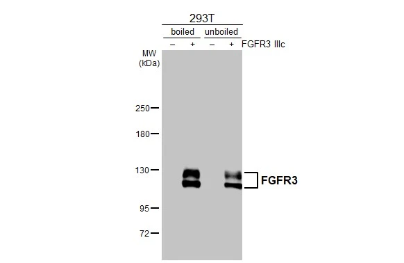 Non-transfected (–) and transfected (+) boiled and unboiled 293T whole cell extracts (30 μg) were separated by 5% SDS-PAGE, and the membrane was blotted with FGFR3 antibody [HL1595] (GTX637074) diluted at 1:5000. The HRP-conjugated anti-rabbit IgG antibody (GTX213110-01) was used to detect the primary antibody, and the signal was developed with Trident ECL plus-Enhanced.