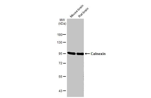 Various tissue extracts (50 μg) were separated by 7.5% SDS-PAGE, and the membrane was blotted with Calnexin antibody [HL1598] (GTX637077) diluted at 1:1000. The HRP-conjugated anti-rabbit IgG antibody (GTX213110-01) was used to detect the primary antibody.