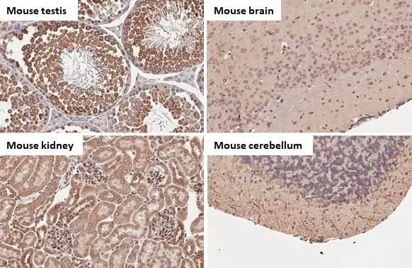Calnexin antibody [HL1598] detects Calnexin protein by immunohistochemical analysis. Sample: Paraffin-embedded mouse tissues. Calnexin stained by Calnexin antibody [HL1598] (GTX637077) diluted at 1:100. Antigen Retrieval: Citrate buffer, pH 6.0, 15 min