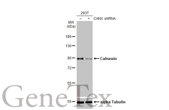 Non-transfected (–) and transfected (+) 293T whole cell extracts were separated by 7.5% SDS-PAGE, and the membrane was blotted with Calnexin antibody [HL1598] (GTX637077) diluted at 1:2000. The HRP-conjugated anti-rabbit IgG antibody (GTX213110-01) was used to detect the primary antibody.