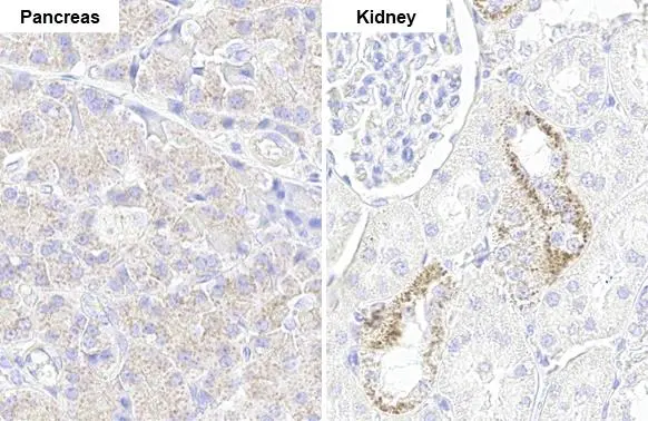 NDUFV1 antibody [HL1600] detects NDUFV1 protein by immunohistochemical analysis. Sample: Paraffin-embedded rat tissues. NDUFV1 stained by NDUFV1 antibody [HL1600] (GTX637079) diluted at 1:100. Antigen Retrieval: Citrate buffer, pH 6.0, 15 min