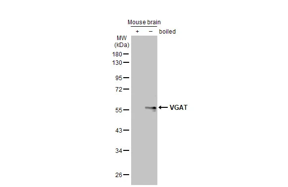 Boiled and unboiled mouse tissue extract (50 μg) were separated by 10% SDS-PAGE, and the membrane was blotted with VGAT antibody [HL1615] (GTX637106) diluted at 1:3000. The HRP-conjugated anti-rabbit IgG antibody (GTX213110-01) was used to detect the primary antibody.