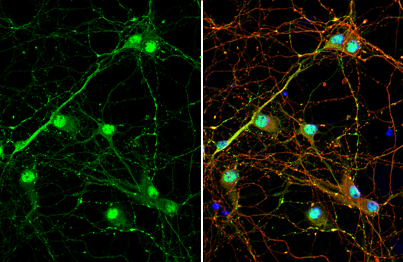 VGAT antibody [HL1616] detects VGAT protein at nucleus and cytoskeleton by immunofluorescent analysis. Sample: DIV9 rat E18 primary cortical neuron cells were fixed in 4% paraformaldehyde at RT for 15 min. Green: VGAT stained by VGAT antibody [HL1616] (GTX637107) diluted at 1:250. Red: Tau, an axon marker, stained by Tau antibody [GT287] (GTX634809) diluted at 1:500. Blue: Fluoroshield with DAPI (GTX30920).