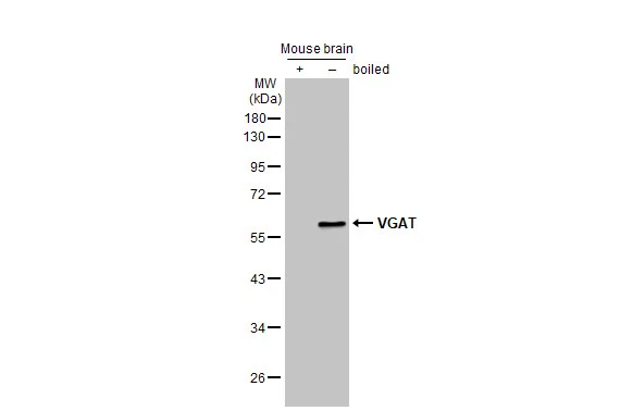 Boiled and unboiled mouse tissue extract (50 μg) were separated by 10% SDS-PAGE, and the membrane was blotted with VGAT antibody [HL1616] (GTX637107) diluted at 1:5000. The HRP-conjugated anti-rabbit IgG antibody (GTX213110-01) was used to detect the primary antibody.