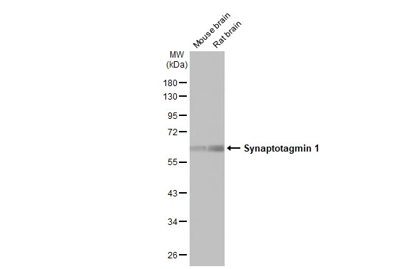 Various tissue extracts (50 μg) were separated by 10% SDS-PAGE, and the membrane was blotted with Synaptotagmin 1 antibody [HL1626] (GTX637119) diluted at 1:20000. The HRP-conjugated anti-rabbit IgG antibody (GTX213110-01) was used to detect the primary antibody.