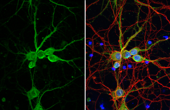 Delta 2 Catenin antibody [HL1629] detects delta 2 Catenin protein at dendrite by immunofluorescent analysis. Sample: DIV9 rat E18 primary cortical neuron cells were fixed in 4% paraformaldehyde at RT for 15 min. Green: delta 2 Catenin stained by delta 2 Catenin antibody [HL1629] (GTX637122) diluted at 1:250. Red: Tau, an axon marker, stained by Tau antibody [GT287] (GTX634809) diluted at 1:500. Blue: Fluoroshield with DAPI (GTX30920).