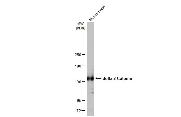 Mouse tissue extract (50 Aμg) was separated by 5% SDS-PAGE, and the membrane was blotted with delta 2 Catenin antibody [HL1629] (GTX637122) diluted at 1:1000. The HRP-conjugated anti-rabbit IgG antibody (GTX213110-01) was used to detect the primary antibody.