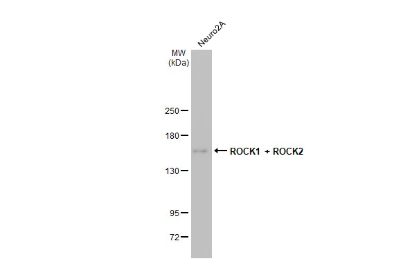 Anti-ROCK1 + ROCK2 antibody [HL1632] (GTX637125) | GeneTex