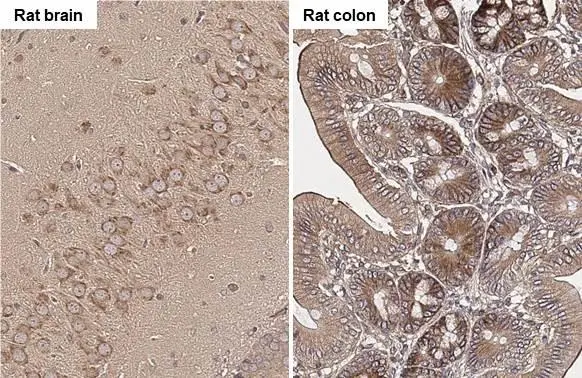 ROCK1 + ROCK2 antibody [HL1632] detects ROCK1 + ROCK2 protein by immunohistochemical analysis. Sample: Paraffin-embedded rat tissues. ROCK1 + ROCK2 stained by ROCK1 + ROCK2 antibody [HL1632] (GTX637125) diluted at 1:200. Antigen Retrieval: Citrate buffer, pH 6.0, 15 min