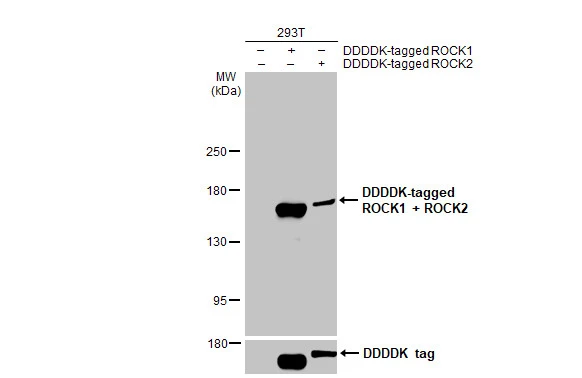 Non-transfected (–) and transfected (+) 293T whole cell extract (30 μg) were separated by 5% SDS-PAGE, and the membrane was blotted with ROCK1 + ROCK2 antibody [HL1632] (GTX637125) diluted at 1:5000. The HRP-conjugated anti-rabbit IgG antibody (GTX213110-01) was used to detect the primary antibody.