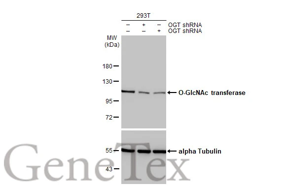 Non-transfected (–) and transfected (+) 293T whole cell extracts (30 μg) were separated by 7.5% SDS-PAGE, and the membrane was blotted with O-GlcNAc transferase antibody [HL1641] (GTX637222) diluted at 1:1000. The HRP-conjugated anti-rabbit IgG antibody (GTX213110-01) was used to detect the primary antibody.