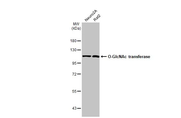 Various whole cell extracts (30 Aμg) were separated by 7.5% SDS-PAGE, and the membrane was blotted with O-GlcNAc transferase antibody [HL1642] (GTX637223) diluted at 1:1000. The HRP-conjugated anti-rabbit IgG antibody (GTX213110-01) was used to detect the primary antibody.