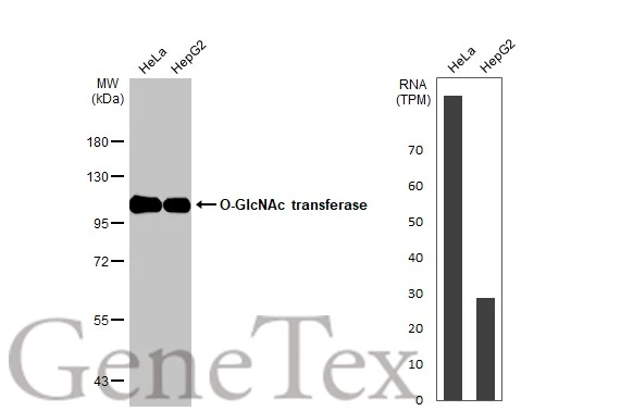 Various whole cell extracts (30 μg) were separated by 7.5% SDS-PAGE, and the membrane was blotted with O-GlcNAc transferase antibody [HL1642] (GTX637223) diluted at 1:1000. The HRP-conjugated anti-rabbit IgG antibody (GTX213110-01) was used to detect the primary antibody. Corresponding RNA expression data for the same cell lines are based on Human Protein Atlas program.