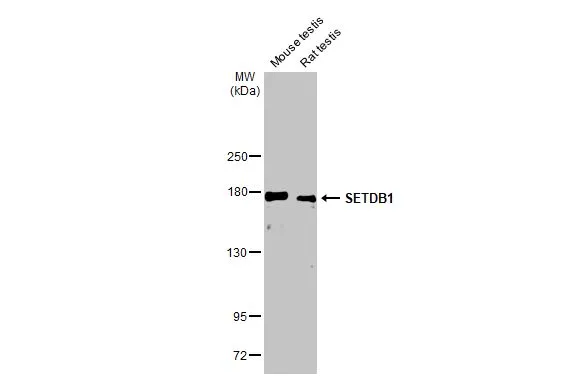 Various tissue extracts (50 Aμg) were separated by 5% SDS-PAGE, and the membrane was blotted with SETDB1 antibody [HL1645] (GTX637226) diluted at 1:5000. The HRP-conjugated anti-rabbit IgG antibody (GTX213110-01) was used to detect the primary antibody.