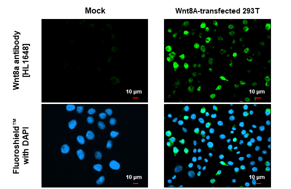 Wnt8a antibody [HL1648] detects Wnt8a protein by immunofluorescent analysis. Sample: Mock and transfected 293T cells were fixed in 4% paraformaldehyde at RT for 15 min. Green: Wnt8a stained by Wnt8a antibody [HL1648] (GTX637229) diluted at 1:500. Blue: Fluoroshield with DAPI (GTX30920). Scale bar= 10μm.