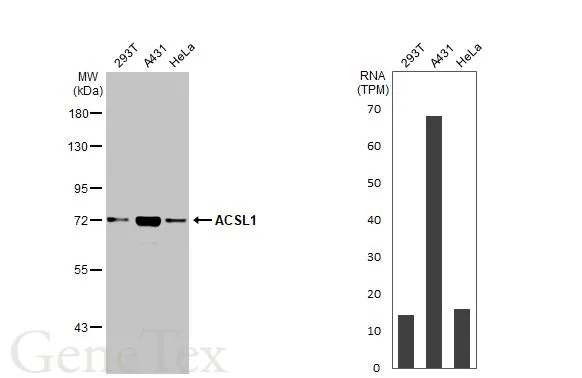 Various whole cell extracts (30 μg) were separated by 7.5% SDS-PAGE, and the membrane was blotted with ACSL1 antibody [HL1651] (GTX637232) diluted at 1:1000. The HRP-conjugated anti-rabbit IgG antibody (GTX213110-01) was used to detect the primary antibody. Corresponding RNA expression data for the same cell lines are based on Human Protein Atlas program.