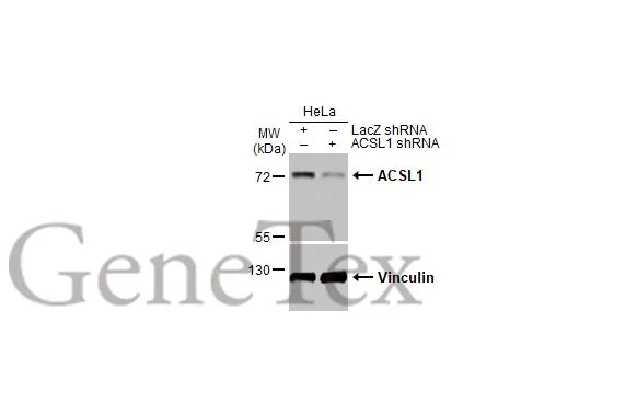 Non-transfected (–) and transfected (+) HeLa whole cell extracts (30 μg) were separated by 7.5% SDS-PAGE, and the membrane was blotted with ACSL1 antibody [HL1651] (GTX637232) diluted at 1:1000. The HRP-conjugated anti-rabbit IgG antibody (GTX213110-01) was used to detect the primary antibody.